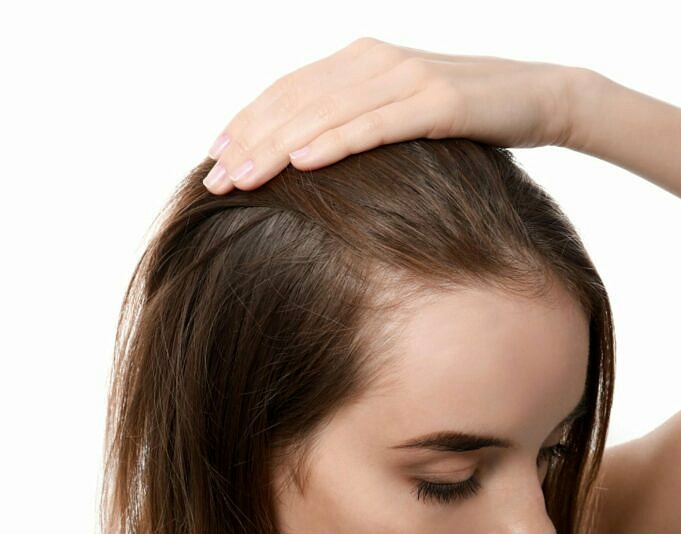 La Perte De Cheveux Est Un Problème Courant. Votre Coiffure Pourrait-elle En être La Cause ?